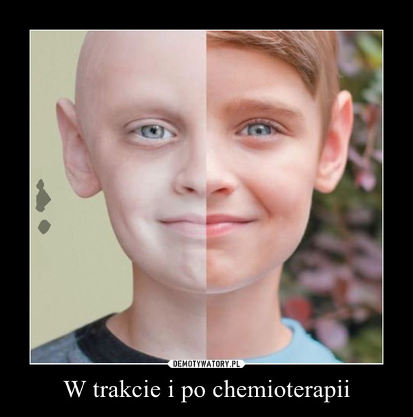 W trakcie i po chemioterapii –  