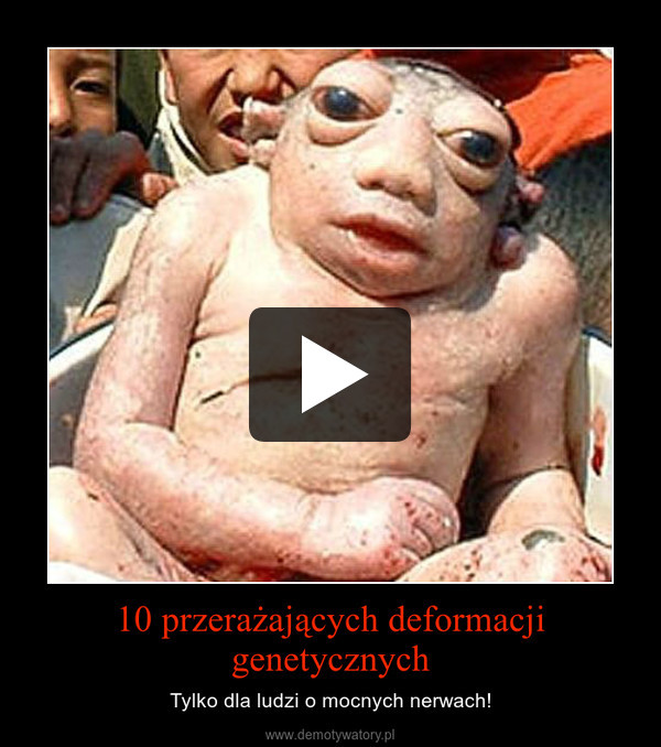 10 przerażających deformacji genetycznych – Tylko dla ludzi o mocnych nerwach! 