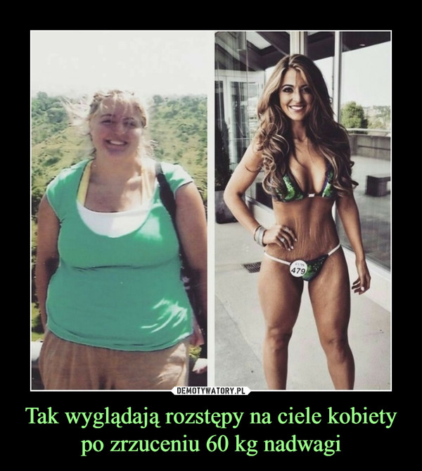 Tak wyglądają rozstępy na ciele kobiety po zrzuceniu 60 kg nadwagi –  