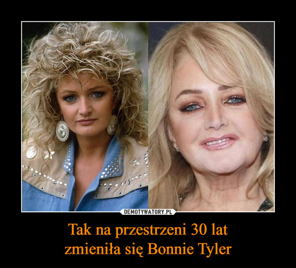 Tak na przestrzeni 30 lat
zmieniła się Bonnie Tyler
