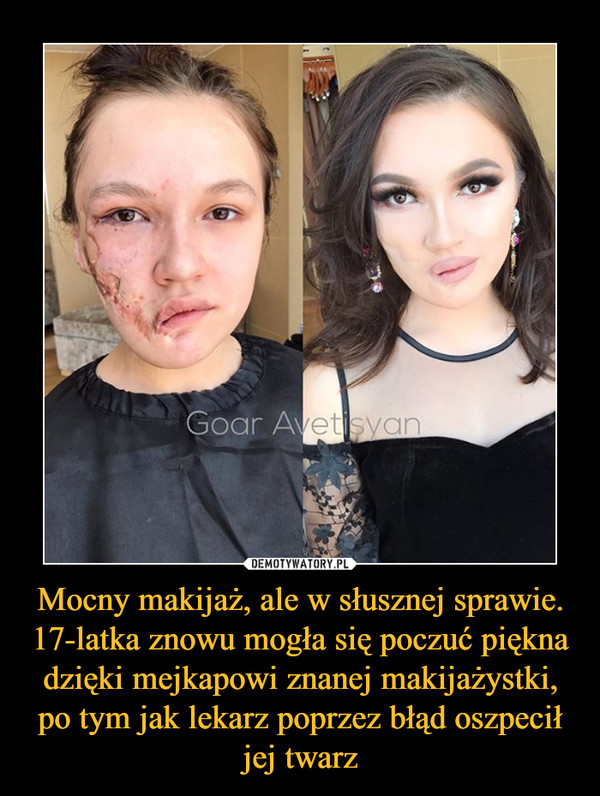 Mocny makijaż, ale w słusznej sprawie. 17-latka znowu mogła się poczuć piękna dzięki mejkapowi znanej makijażystki, po tym jak lekarz poprzez błąd oszpecił jej twarz