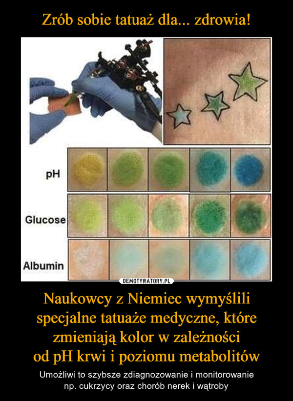 Zrób sobie tatuaż dla... zdrowia! Naukowcy z Niemiec wymyślili specjalne tatuaże medyczne, które zmieniają kolor w zależności
od pH krwi i poziomu metabolitów